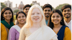 Beyond Myths: Why Schools Must Observe International Albinism Awareness Day 2026