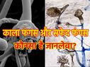 Black Vs White Fungus: ब्लैक फंगस और व्हाइट फंगस में फर्क, जानिए लक्षण और उपचार