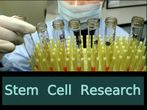What is Stem Cell Research? Scope and Career Opportunities