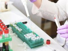 10वीं के बाद करें मेडिकल लेबोरेटरी टेक्नोलॉजी (डीएमएलटी) में डिप्लोमा: जानिए कोर्स डिटेल