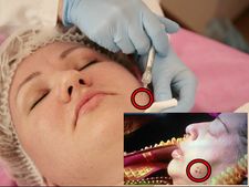 எங்கு படிக்கலாம்? அறுவதிலும் இருவது 'லுக்' டெர்மடாலஜி!