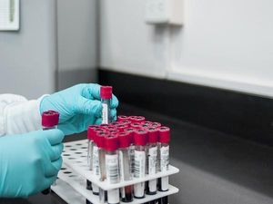 Highly Paid Career Opportunities in Zoology