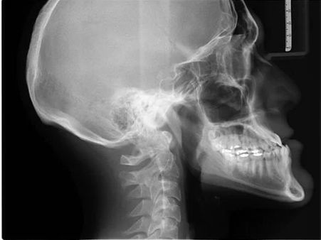 What is the expected Average Salary of a Radiologist? 
