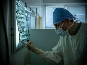 रेडियोलॉजी में डिप्लोमा कैसे करें, जानिए कोर्स, फीस और टॉप कॉलेज के बारे में