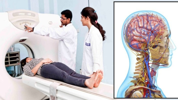 Top Neurology Colleges in India 